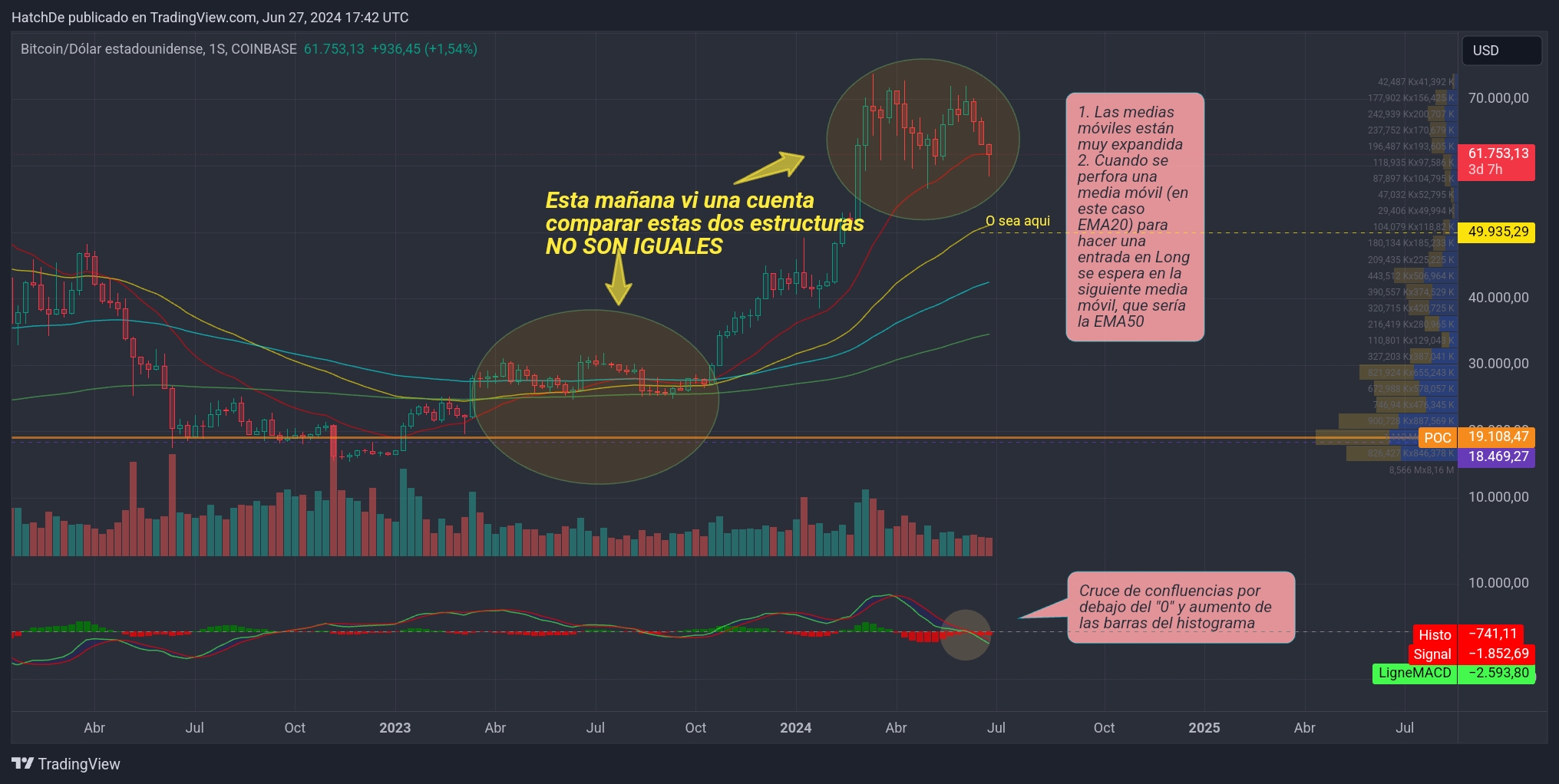 TradingView_Screenshot_1719510156540.jpg